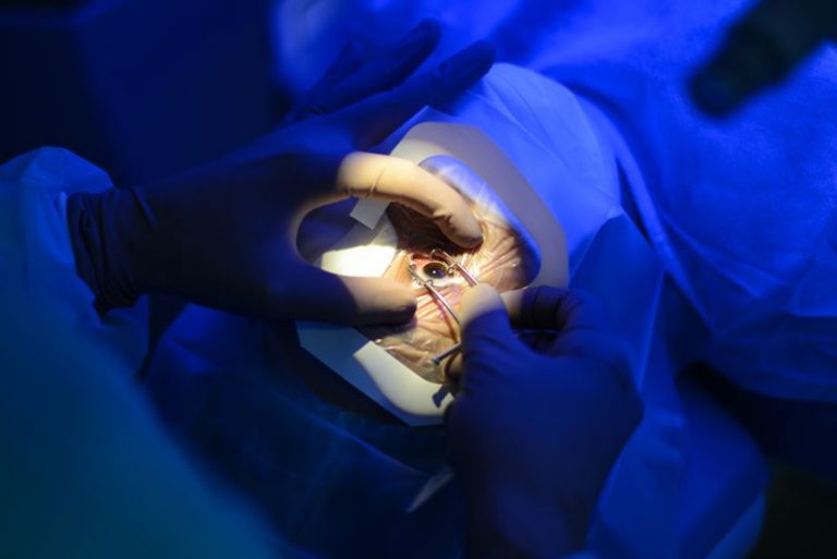 Read more about the article Portugal pode tornar-se autossuficiente no transplante de córneas